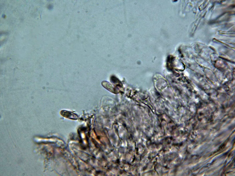 Butyriboletus subappendiculatus 10 - Basidios